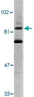 PAB13402 - IKKA