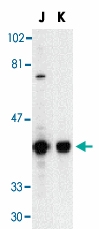 PAB13403 - DFFB / CAD