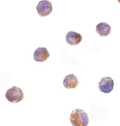 PAB13404 - DFFB / CAD