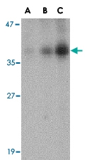 PAB13404 - DFFB / CAD