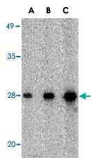 PAB13406 - CIDE-B