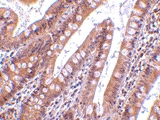 PAB13406 - CIDE-B