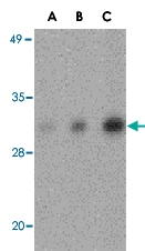 PAB13407 - CIDE-B