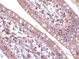 PAB13407 - CIDE-B