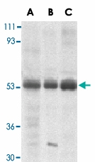 PAB13408 - TRIM5 / RNF88