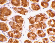 PAB13408 - TRIM5 / RNF88