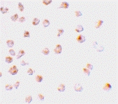 PAB13414 - MCL1