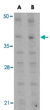 PAB13414 - MCL1