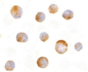 PAB13415 - MCL1