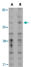 PAB13415 - MCL1