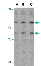 PAB13416 - MCL1