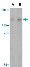 PAB13417 - RAPTOR