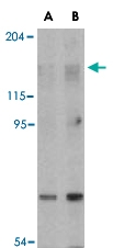 PAB13418 - RAPTOR