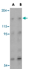 PAB13419 - RAPTOR