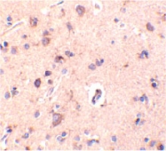 PAB13420 - C1QTNF2