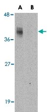 PAB13421 - C1QTNF2