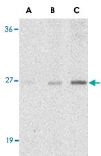 PAB13423 - C1QTNF7