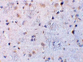 PAB13423 - C1QTNF7