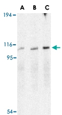 PAB13424 - ERN1 / IRE1