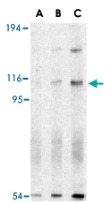PAB13425 - ERN1 / IRE1