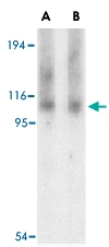 PAB13426 - ERN1 / IRE1