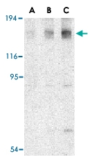 PAB13429 - MEKK5 / ASK1