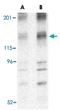 PAB13430 - MEKK5 / ASK1