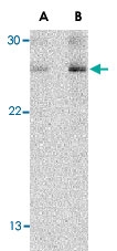 PAB13434 - TSLP