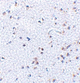 PAB13434 - TSLP