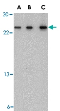 PAB13435 - TSLP