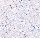 PAB13435 - TSLP