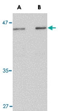 PAB13440 - LASS5