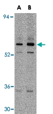 PAB13441 - CFLAR / Casper / I-FLICE