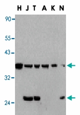 PAB13442 - CFLAR / Casper / I-FLICE