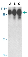 PAB13443 - ACE2