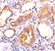 PAB13443 - ACE2