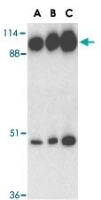 PAB13444 - ACE2