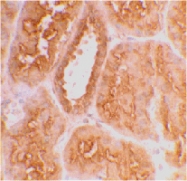 PAB13444 - ACE2