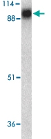 PAB13445 - ACE2