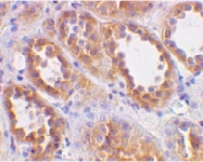 PAB13445 - ACE2