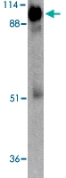 PAB13446 - ACE2