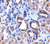 PAB13446 - ACE2