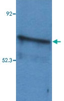 PAB13541 - B-cell linker protein / BLNK