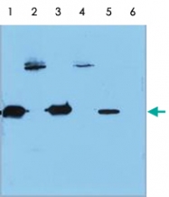PAB13542 - Neisseria meningitidis
