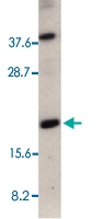 PAB13553 - RAIDD