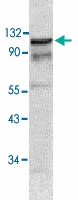 PAB13554 - DAXX