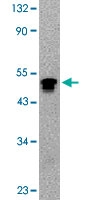 PAB13558 - DAPK3 / ZIPK