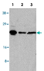 PAB13559 - ARC / ARG3.1