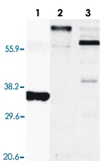 PAB13566 - CD254 / RANKL