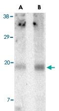PAB13568 - IAP4 / BIRC5